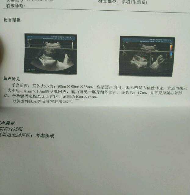 内蒙供卵试管价格贵吗，上海公立医院做供卵试管婴儿需要结婚证吗